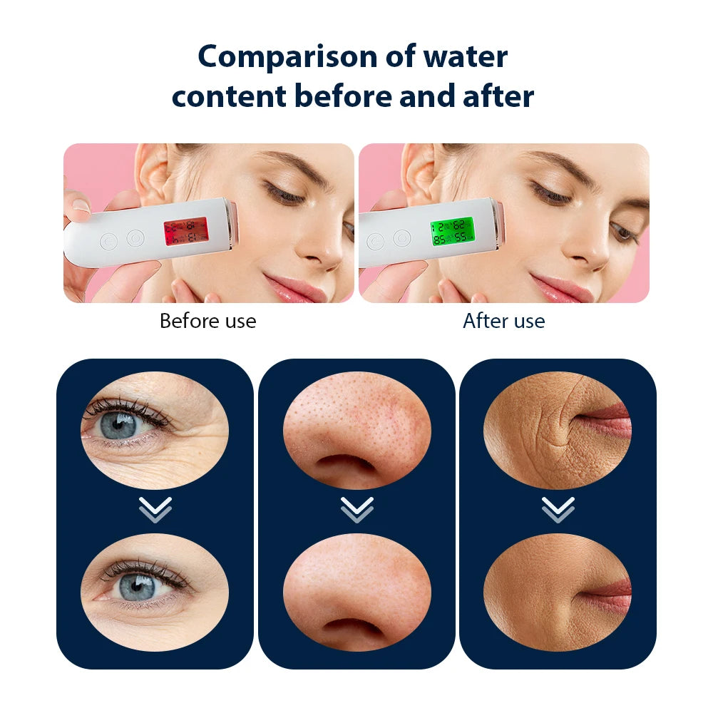 Iebilif Led Oxygen Bubble Pen Facial Massager For Skin Rejuvenation